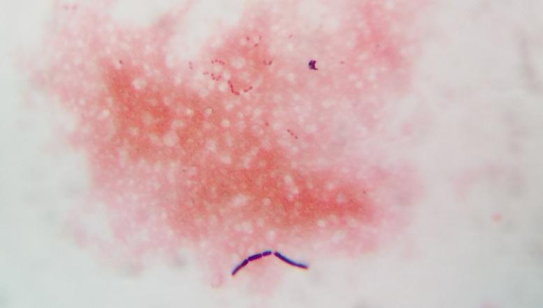 Mikroskopiranje bakterij in kvasovk