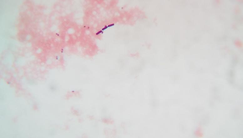 Mikroskopiranje bakterij in kvasovk